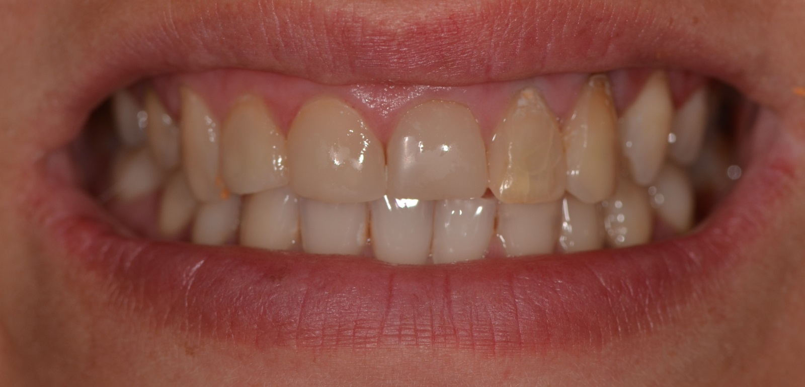 Фото клиники Smile Центр